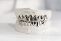 Custom Grillz